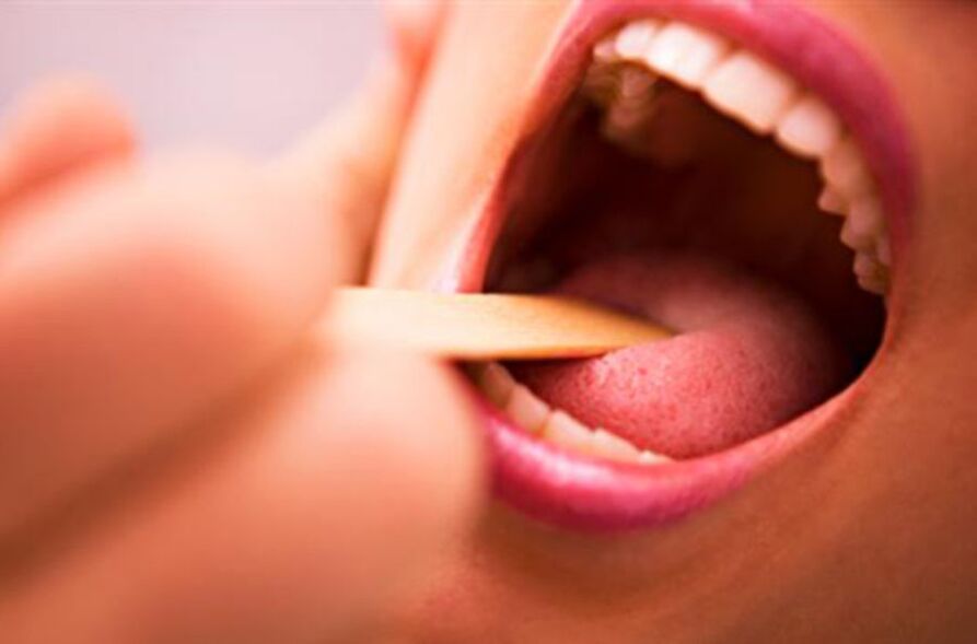 Tipi di parassiti nella bocca umana